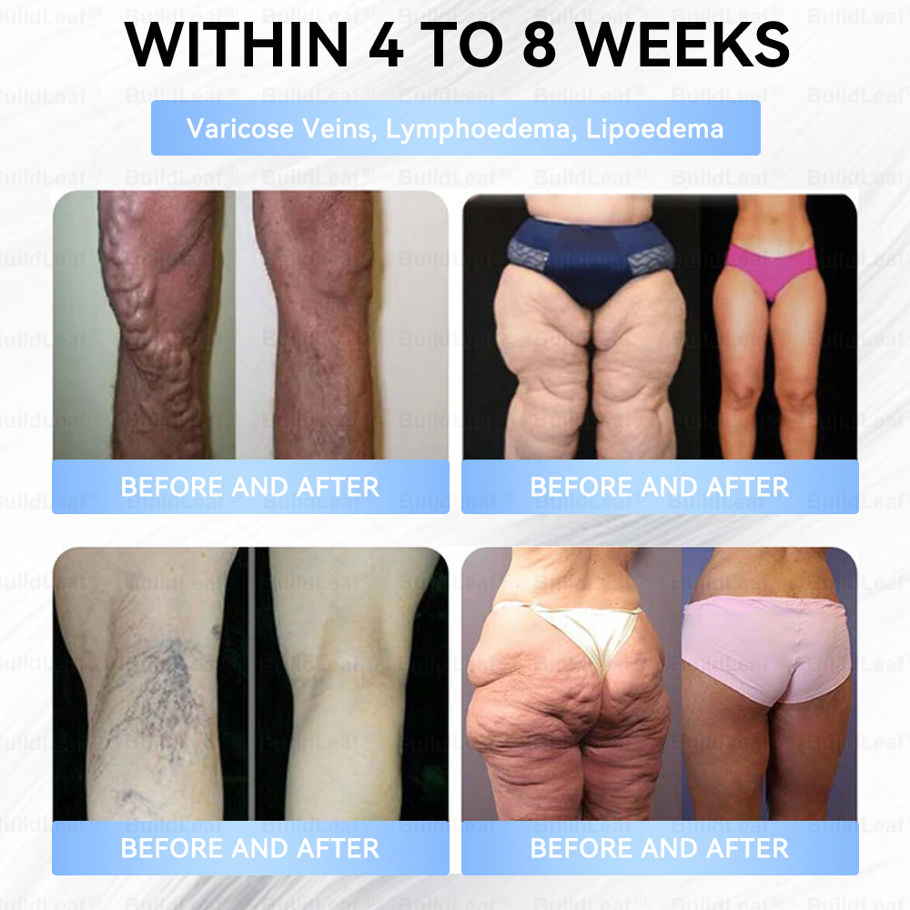 FDA Store·𝐁𝐮𝐢𝐥𝗱𝐋𝐞𝐚𝐟®𝐒𝐥𝐢𝐦 & 𝐅𝐢𝐫𝐦 𝐍𝐚𝐧𝐨 𝐌𝐢𝐜𝐫𝐨𝐧𝐞𝐞𝐝𝐥𝐞 𝐏𝐚𝐭𝐜𝐡 𝐰𝐢𝐭𝐡 𝐌𝐨𝐫𝐢𝐧𝐠𝐚, 𝐎𝐦𝐞𝐠𝐚-𝟑, 𝐂𝐨𝐥𝐥𝐚𝐠𝐞𝐧 𝐏𝐞𝐩𝐭𝐢𝐝𝐞𝐬, 𝐍𝐀𝐃 & 𝐍𝐌𝐍 𝐟𝐨𝐫 𝐎𝐛𝐞𝐬𝐢𝐭𝐲, 𝐂𝐚𝐫𝐝𝐢𝐨𝐯𝐚𝐬𝐜𝐮𝐥𝐚𝐫 𝐃𝐢𝐬𝐞𝐚𝐬𝐞, 𝐃𝐢𝐚𝐛𝐞𝐭𝐞𝐬, 𝐒𝐥𝐞𝐞𝐩 𝐀𝐩𝐧𝐞𝐚, 𝐉𝐨𝐢𝐧𝐭 𝐏𝐫𝐨𝐛𝐥𝐞𝐦𝐬, 𝐒𝐤𝐢𝐧 𝐅𝐢𝐫𝐦𝐢𝐧𝐠, 𝐀𝐧𝐭𝐢-𝐀𝐠𝐢𝐧𝐠, 𝐚𝐧𝐝 𝐌𝐨𝐫𝐞