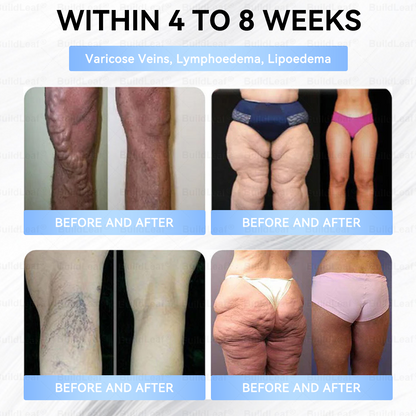 🏥FDA Store |𝐵uil𝗱𝐿ea𝐟® 𝑮𝐋𝑃-1 Slim & Firm 𝑁ano 𝑀icroneedle 𝑃atch with Collagen,Turmeric&Matrixyl 3000 丨Obesity,Cardiovascular Diseas, Diabetes, Sleep Apnea, Joint Problems and More
